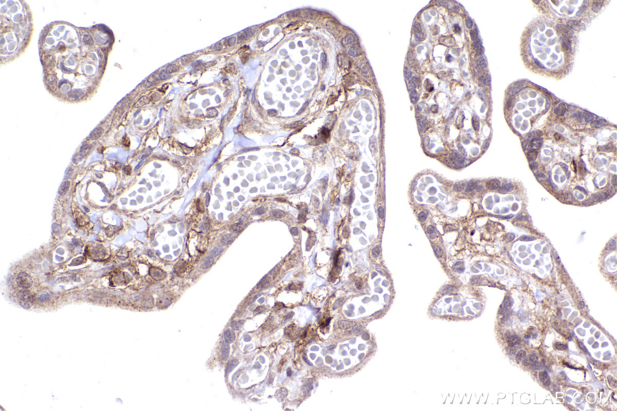 Immunohistochemical analysis of paraffin-embedded human placenta tissue slide using KHC2409 (FAP IHC Kit).