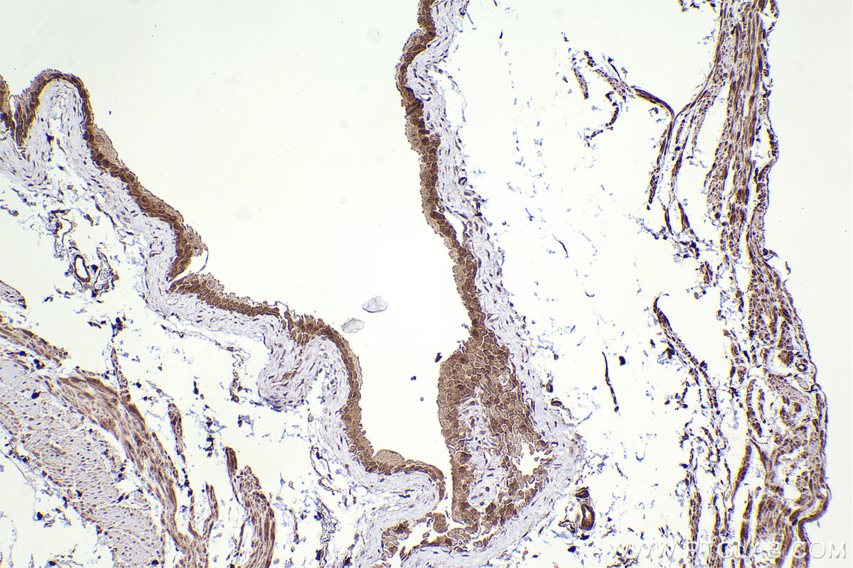 Immunohistochemical analysis of paraffin-embedded mouse bladder tissue slide using KHC2409 (FAP IHC Kit).