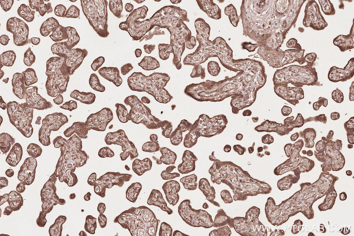 Immunohistochemical analysis of paraffin-embedded human placenta tissue slide using KHC2567 (FBXO31 IHC Kit).