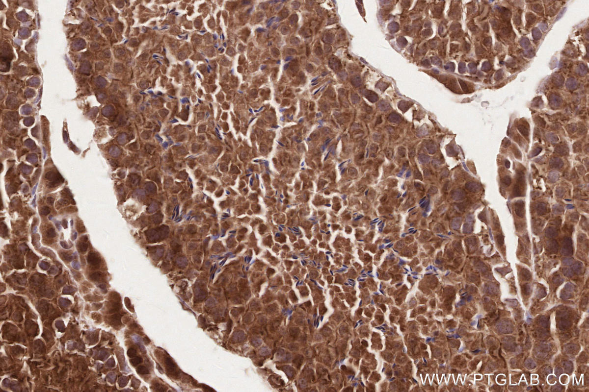 Immunohistochemical analysis of paraffin-embedded mouse testis tissue slide using KHC2567 (FBXO31 IHC Kit).