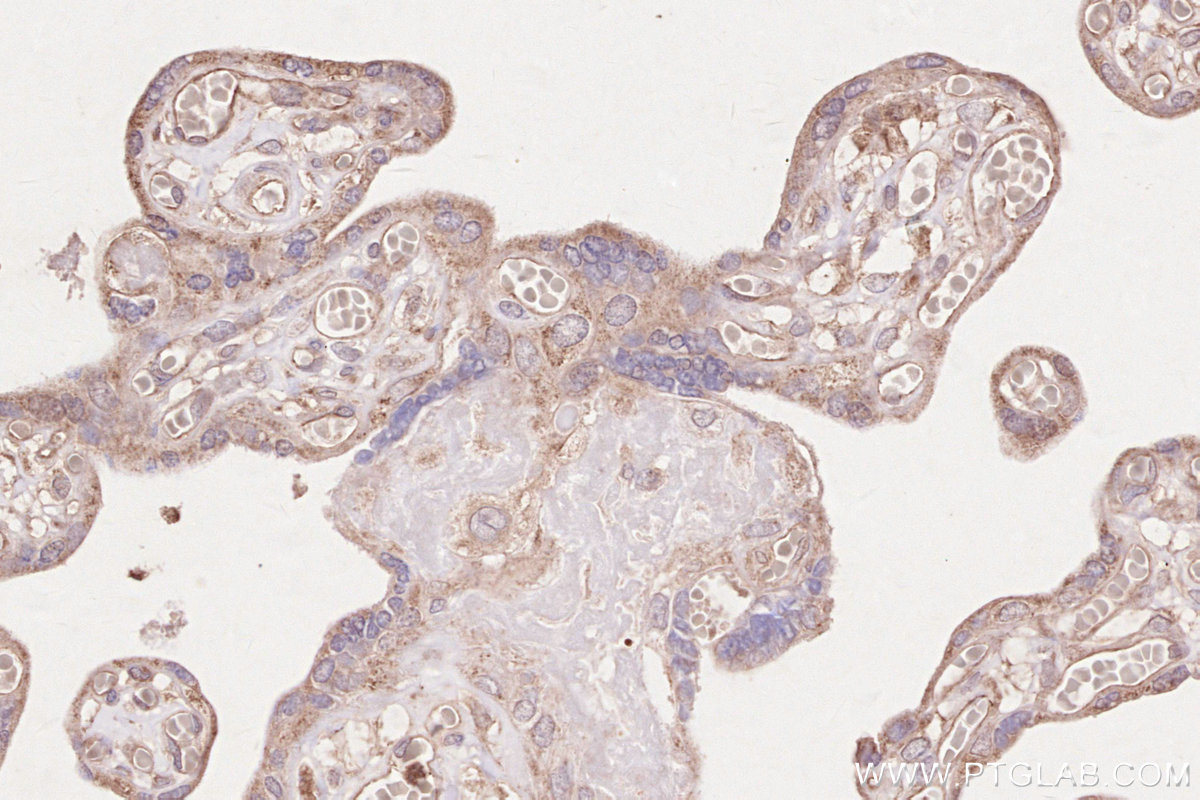 Immunohistochemical analysis of paraffin-embedded human placenta tissue slide using KHC2603 (FGD5 IHC Kit).