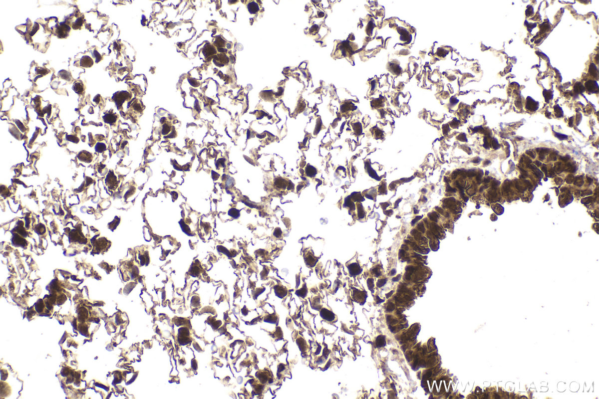 Immunohistochemical analysis of paraffin-embedded rat lung tissue slide using KHC2167 (FH IHC Kit).