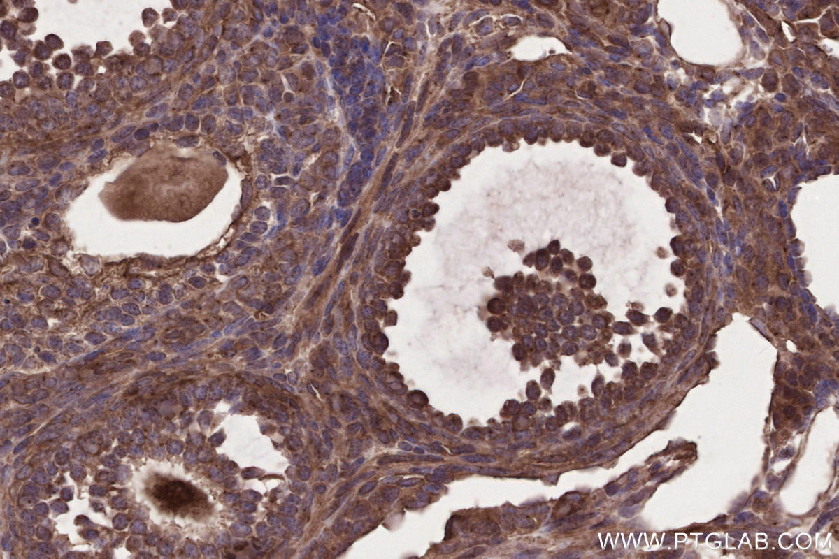 Immunohistochemical analysis of paraffin-embedded mouse ovary tissue slide using KHC2646 (FMNL3 IHC Kit).