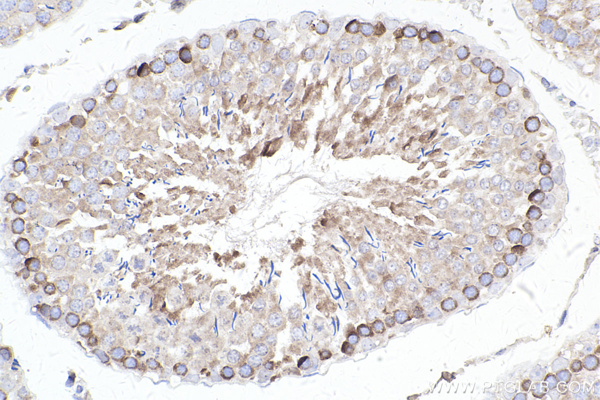 Immunohistochemical analysis of paraffin-embedded rat testis tissue slide using KHC2397 (FMR1 IHC Kit).