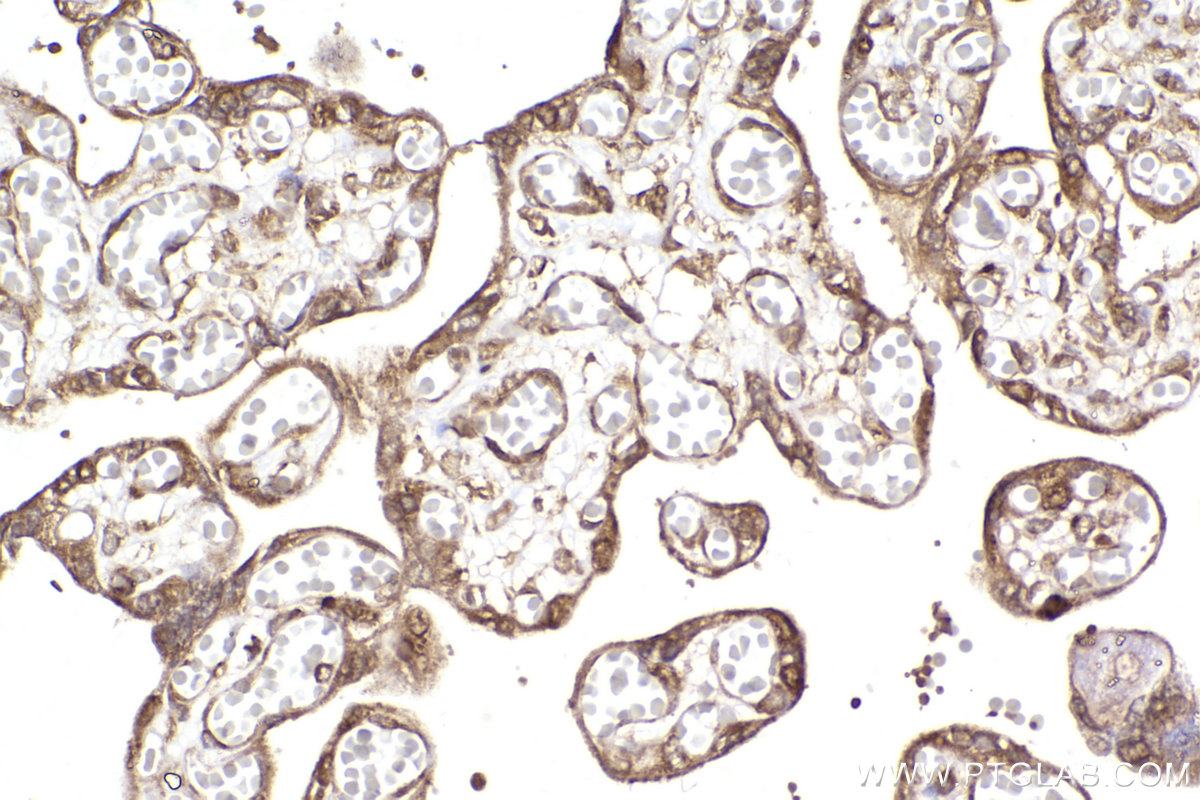 Immunohistochemical analysis of paraffin-embedded human placenta tissue slide using KHC2299 (FXR1 IHC Kit).