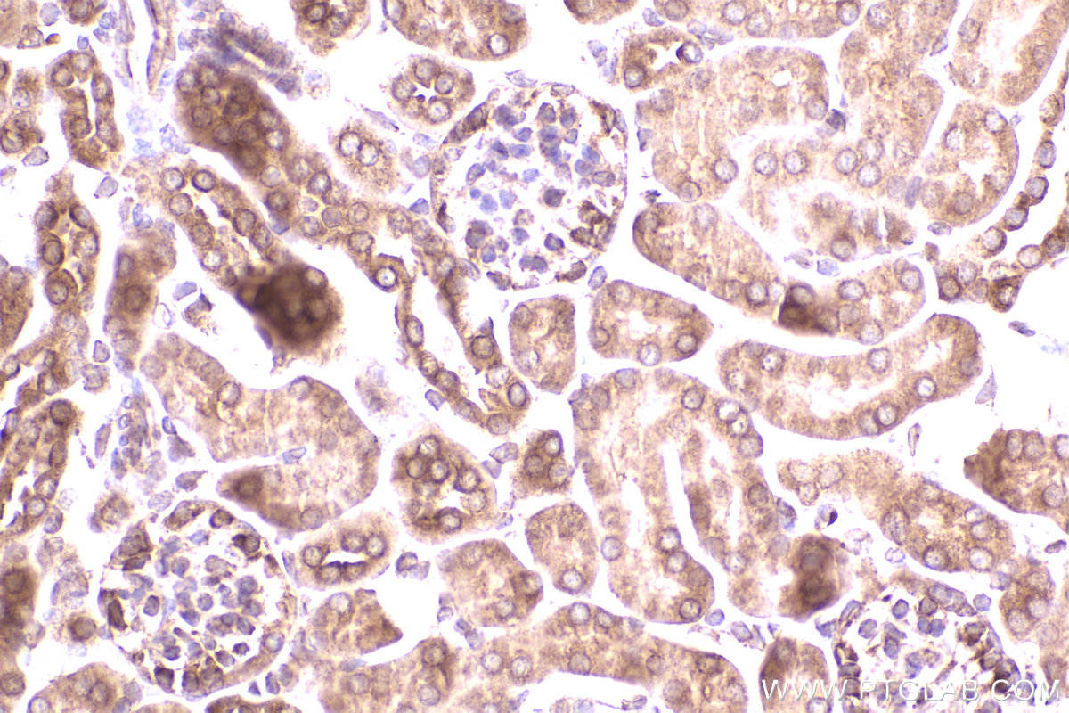 Immunohistochemical analysis of paraffin-embedded mouse kidney tissue slide using KHC2300 (FXR2 IHC Kit).