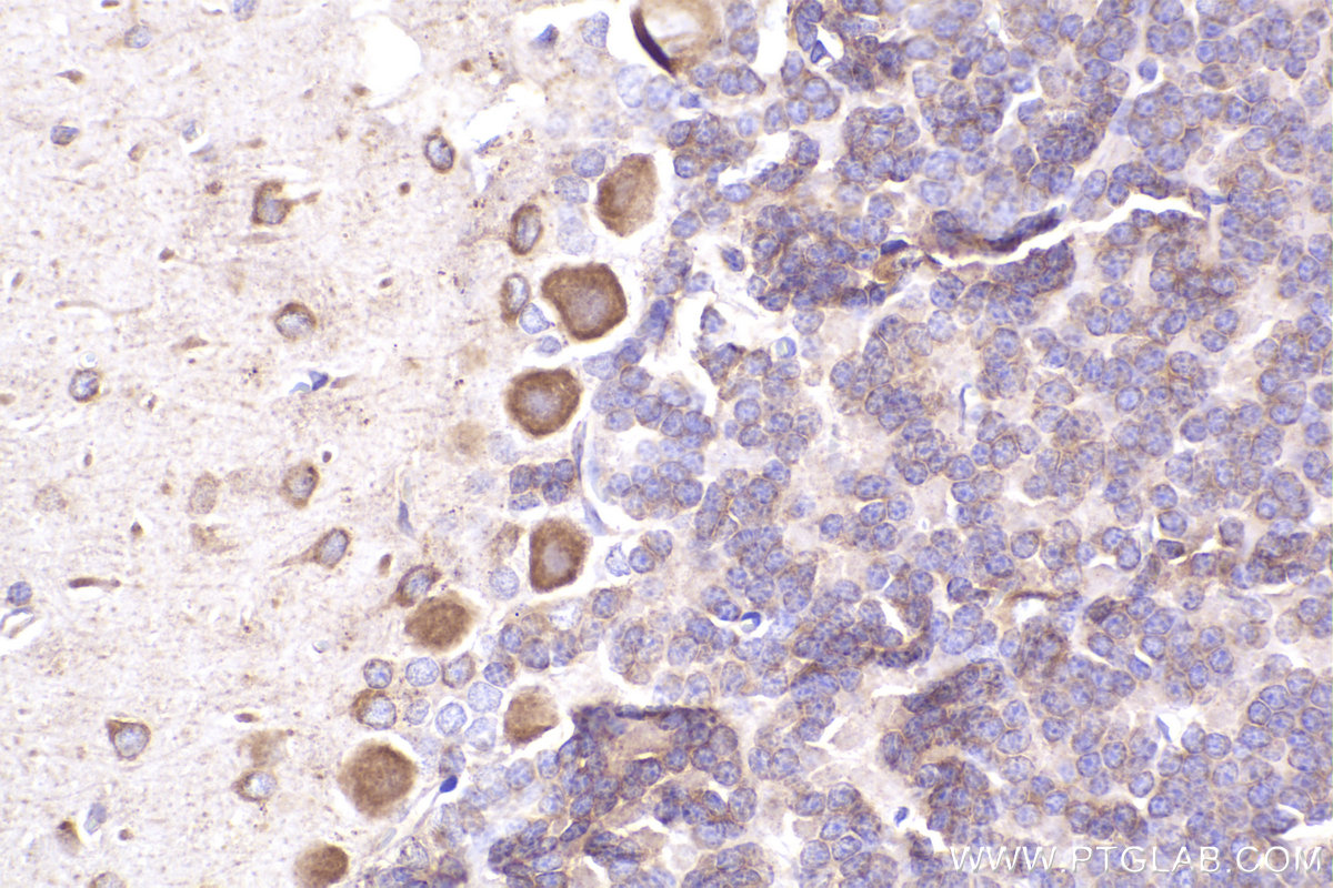 Immunohistochemical analysis of paraffin-embedded rat cerebellum tissue slide using KHC2300 (FXR2 IHC Kit).