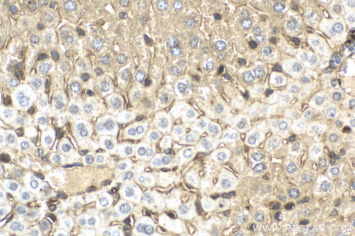 Immunohistochemical analysis of paraffin-embedded mouse liver tissue slide using KHC2164 (FYN IHC Kit).