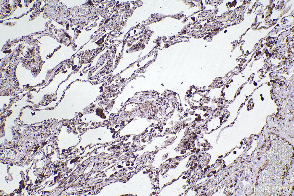 Immunohistochemical analysis of paraffin-embedded human lung tissue slide using KHC2416 (Flightless I IHC Kit).