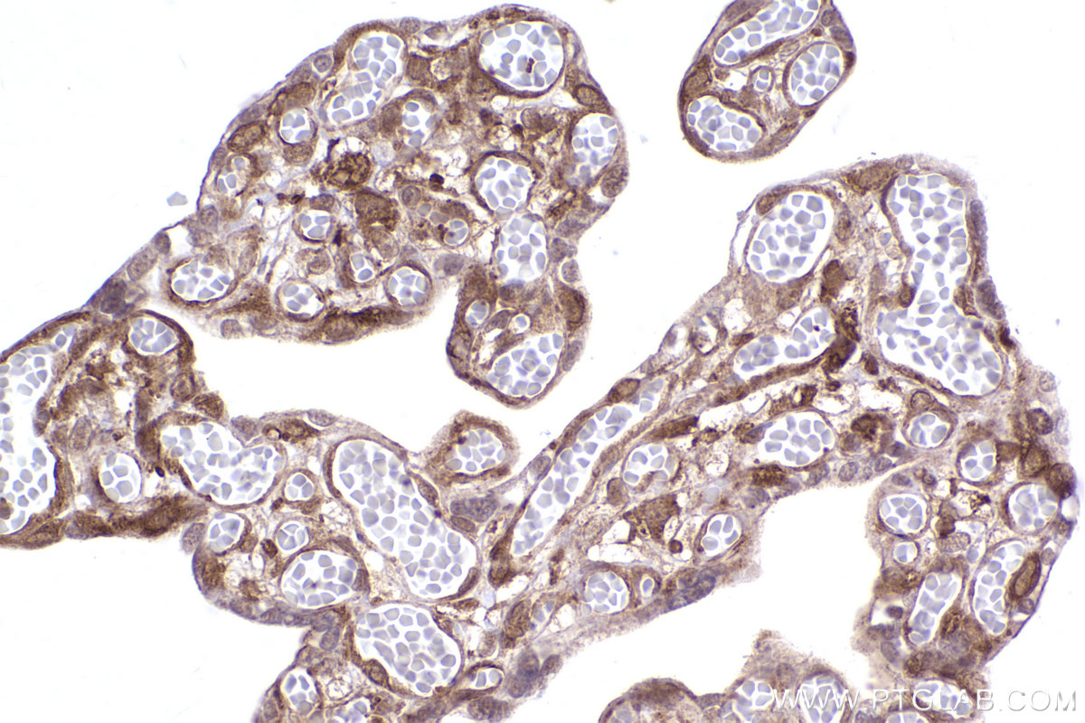 Immunohistochemical analysis of paraffin-embedded human placenta tissue slide using KHC2416 (Flightless I IHC Kit).