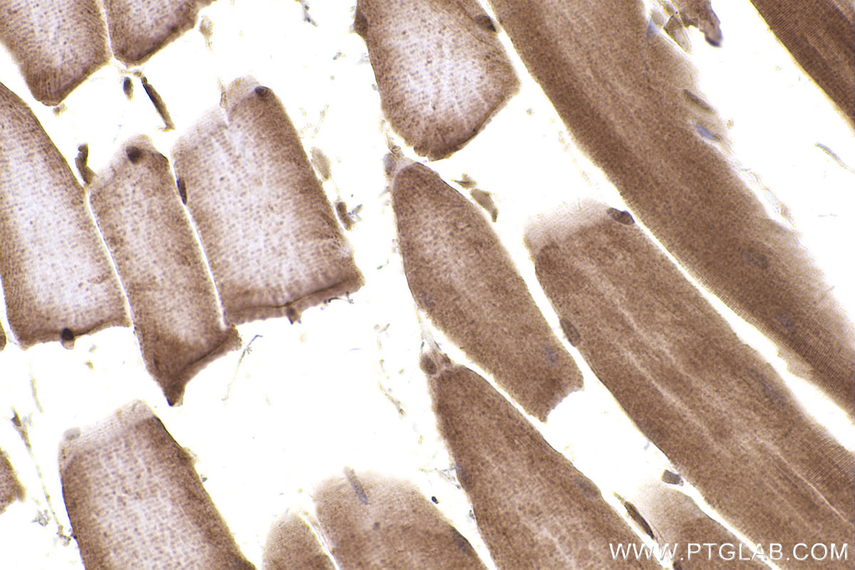 Immunohistochemical analysis of paraffin-embedded mouse skeletal muscle tissue slide using KHC2416 (Flightless I IHC Kit).