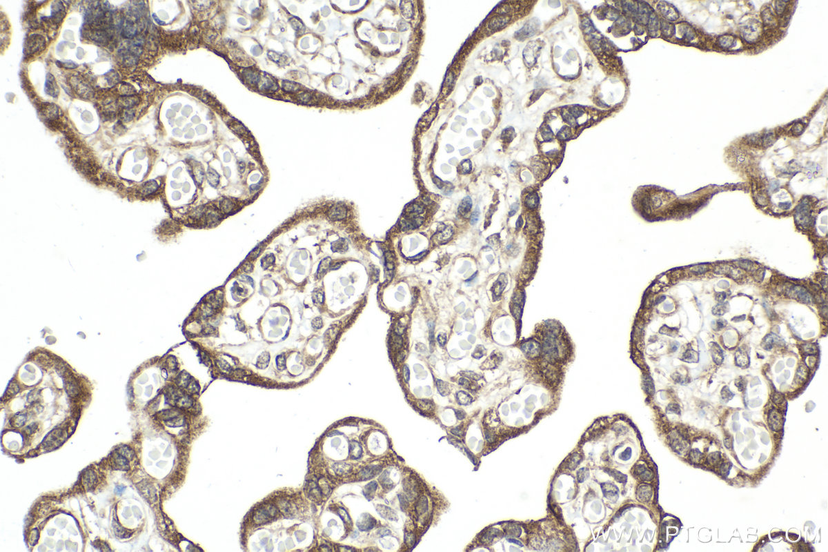 Immunohistochemical analysis of paraffin-embedded human placenta tissue slide using KHC2096 (GDF9 IHC Kit).