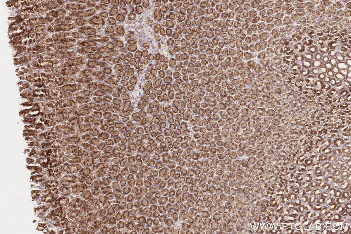 Immunohistochemical analysis of paraffin-embedded rat stomach tissue slide using KHC2601 (GIGYF2 IHC Kit).