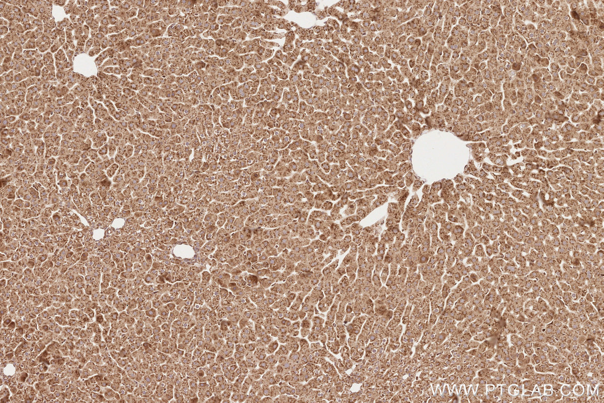 Immunohistochemical analysis of paraffin-embedded rat liver tissue slide using KHC2601 (GIGYF2 IHC Kit).