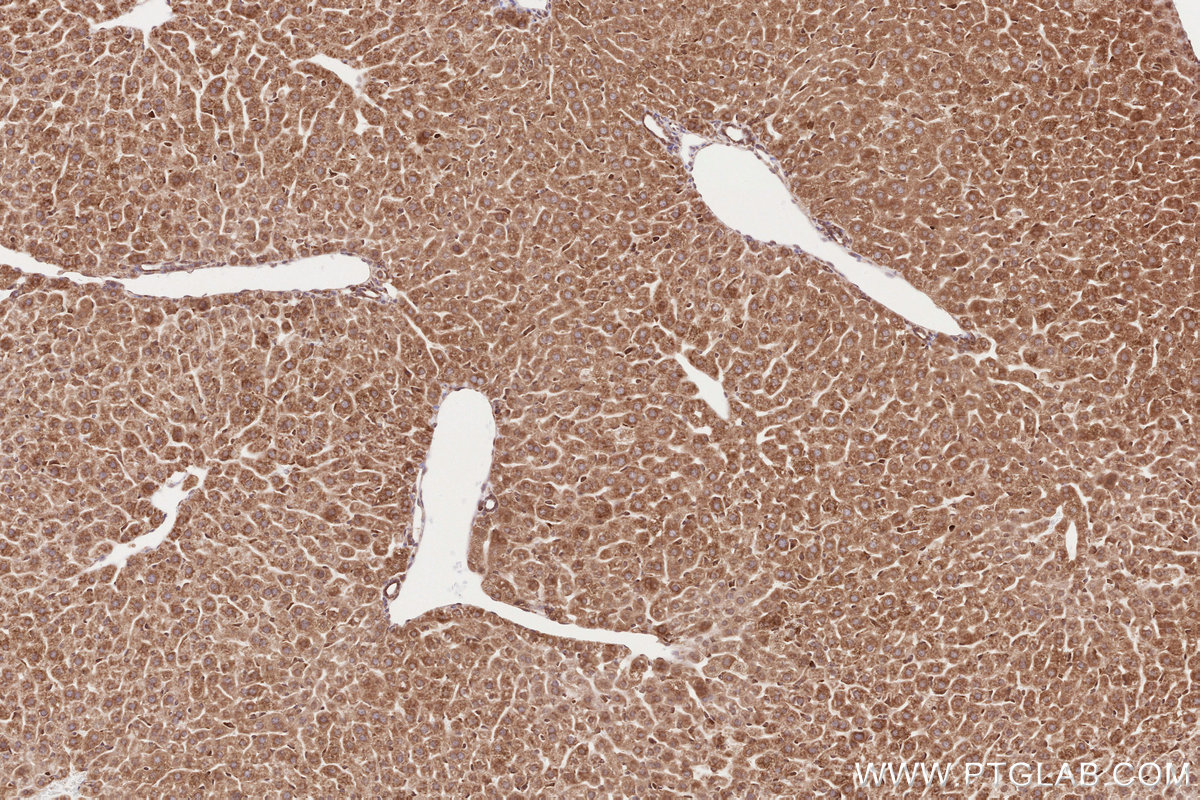 Immunohistochemical analysis of paraffin-embedded mouse liver tissue slide using KHC2601 (GIGYF2 IHC Kit).