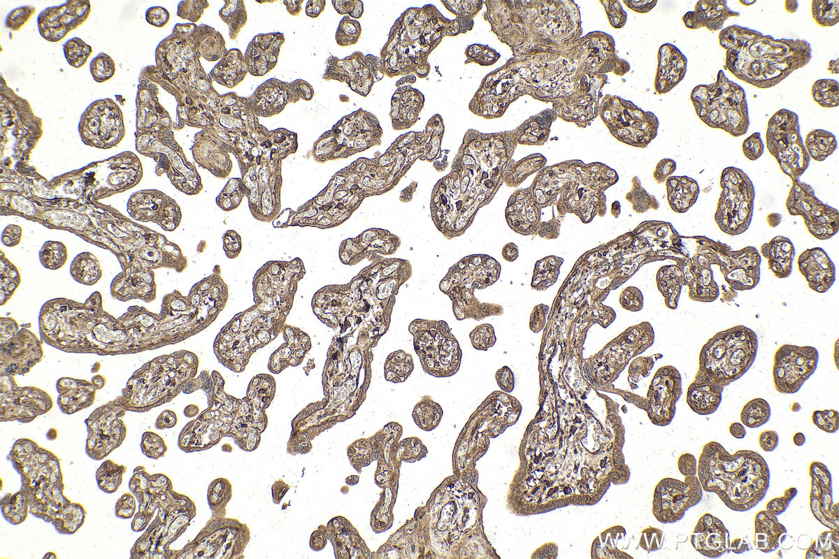 Immunohistochemical analysis of paraffin-embedded human placenta tissue slide using KHC2159 (GNAI2 IHC Kit).
