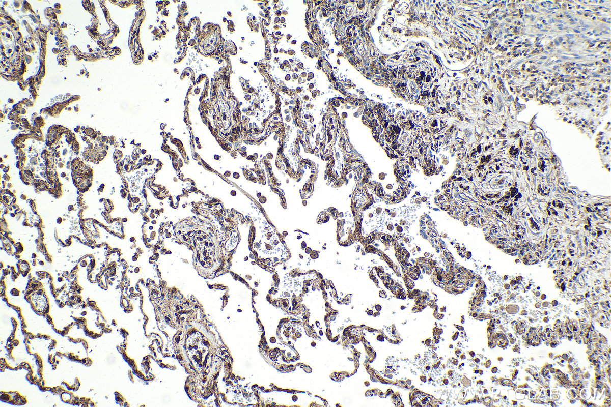 Immunohistochemical analysis of paraffin-embedded human lung tissue slide using KHC2159 (GNAI2 IHC Kit).