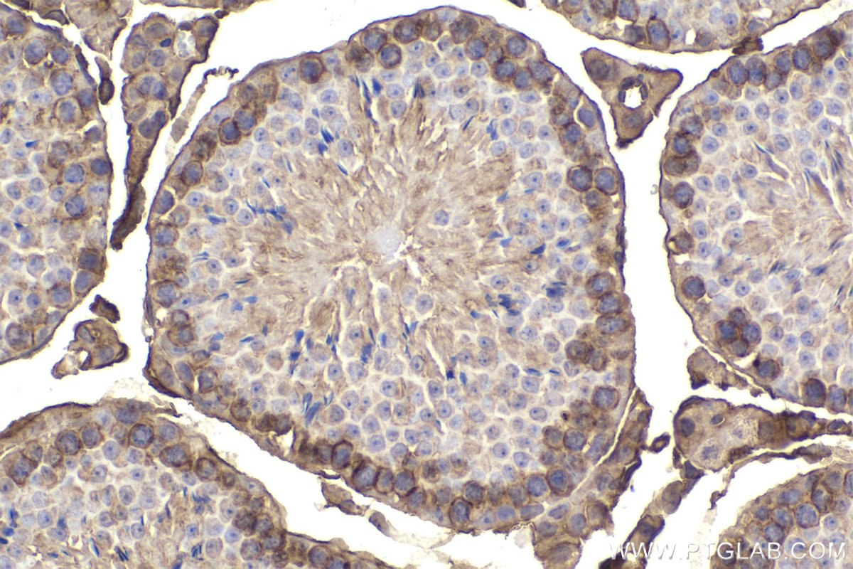 Immunohistochemical analysis of paraffin-embedded mouse testis tissue slide using KHC2171 (GNAI3 IHC Kit).
