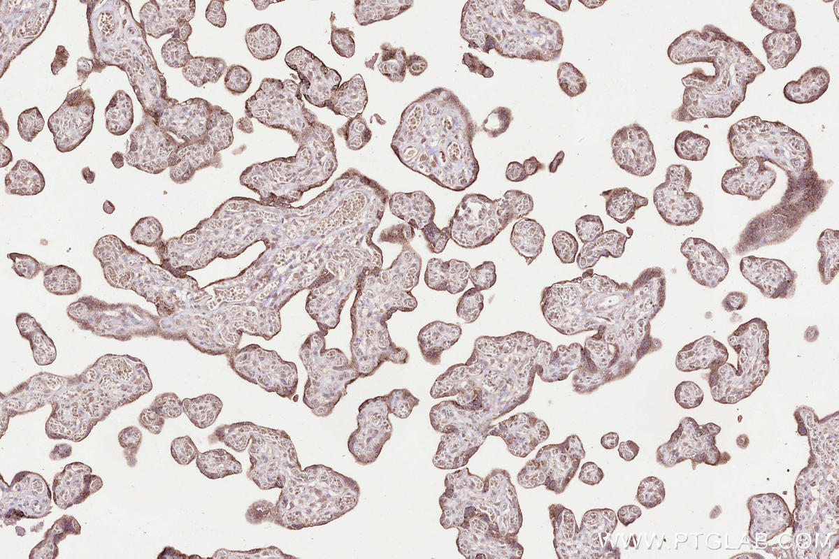 Immunohistochemical analysis of paraffin-embedded human placenta tissue slide using KHC2516 (GPNMB IHC Kit).