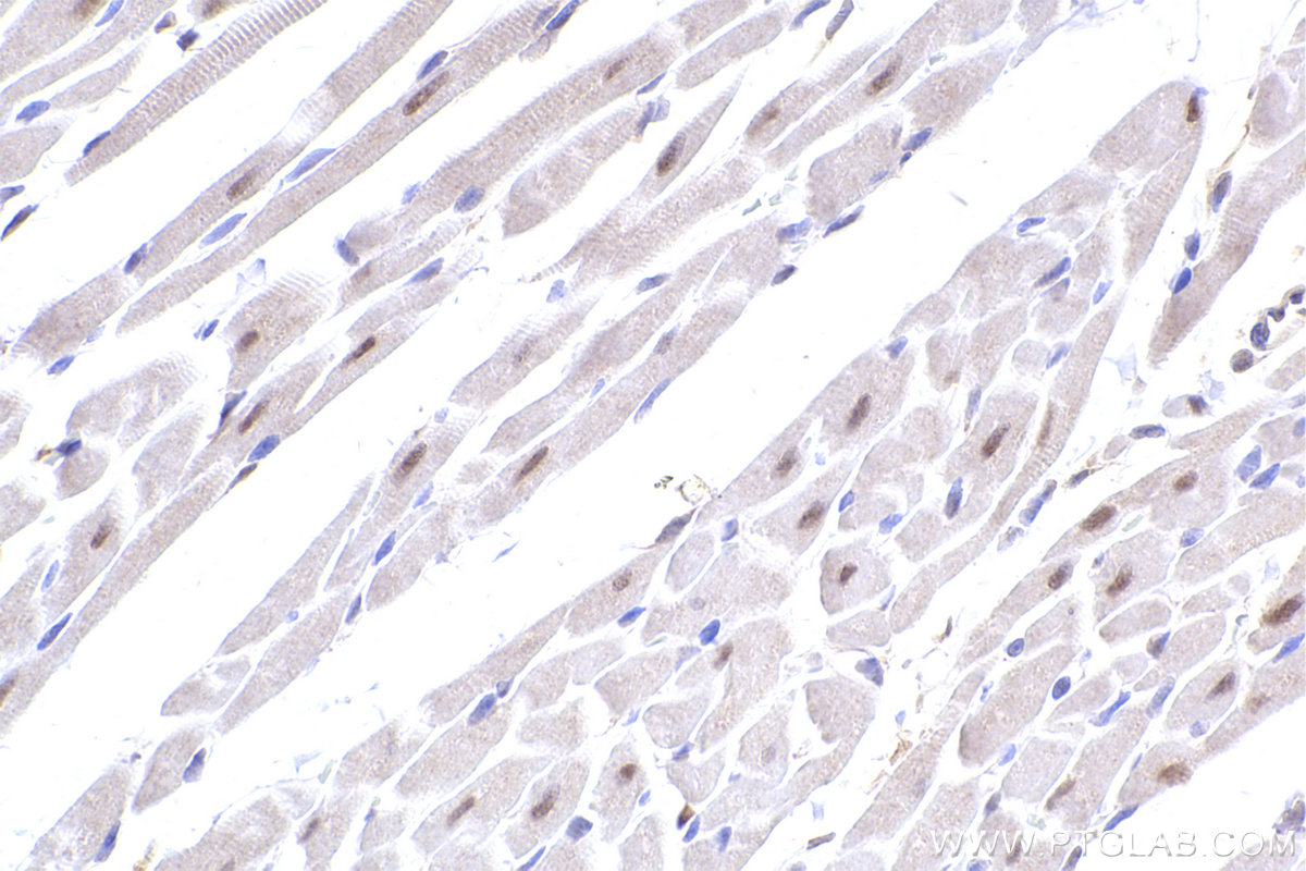 Immunohistochemical analysis of paraffin-embedded rat heart tissue slide using KHC2417 (GPS1/CSN1 IHC Kit).