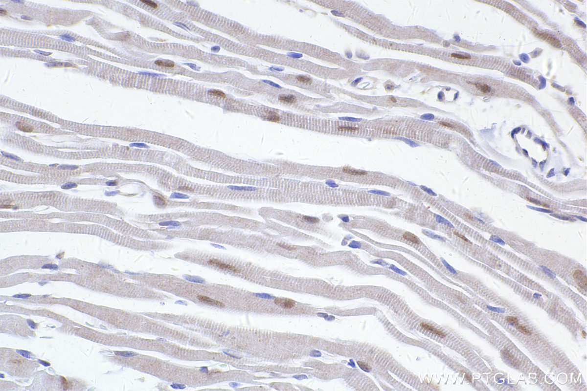 Immunohistochemical analysis of paraffin-embedded mouse heart tissue slide using KHC2417 (GPS1/CSN1 IHC Kit).