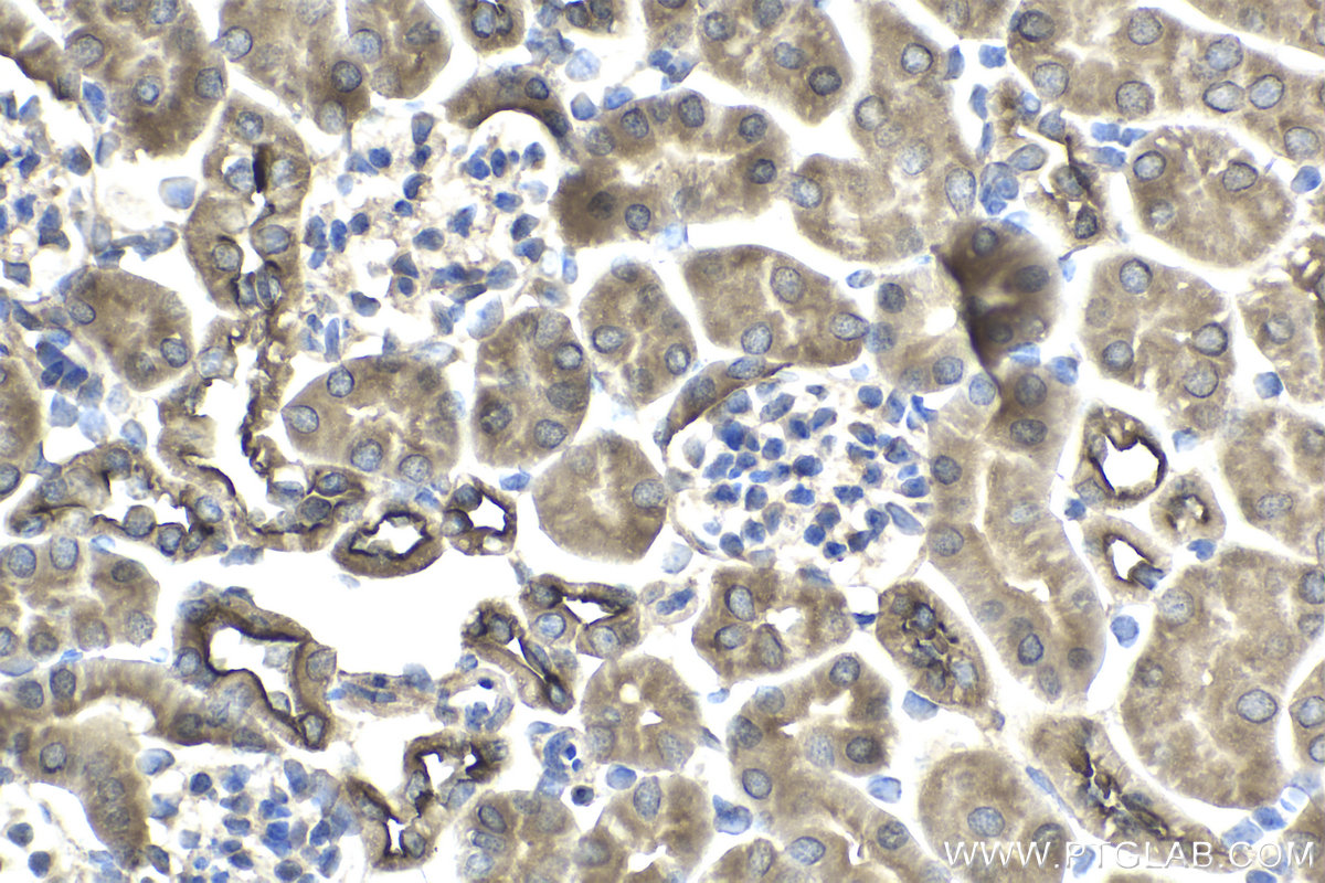 Immunohistochemical analysis of paraffin-embedded mouse kidney tissue slide using KHC1963 (GRLF1 IHC Kit).