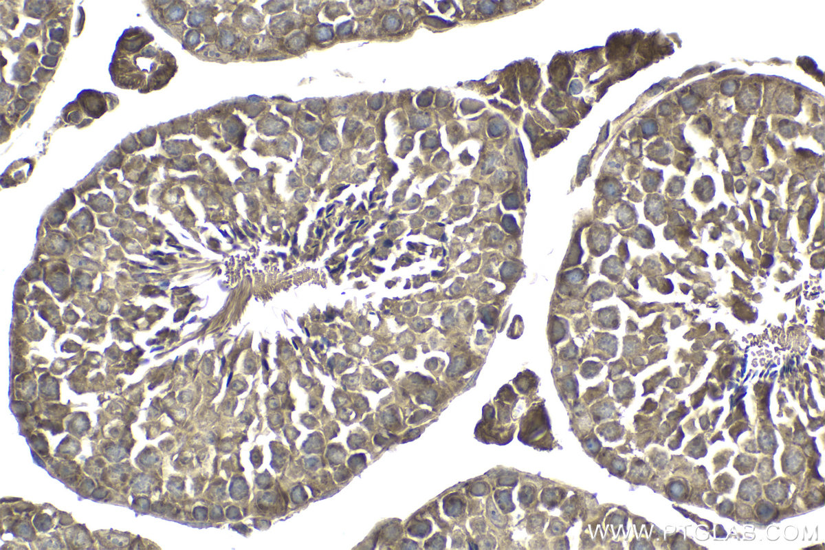 Immunohistochemical analysis of paraffin-embedded mouse testis tissue slide using KHC1963 (GRLF1 IHC Kit).