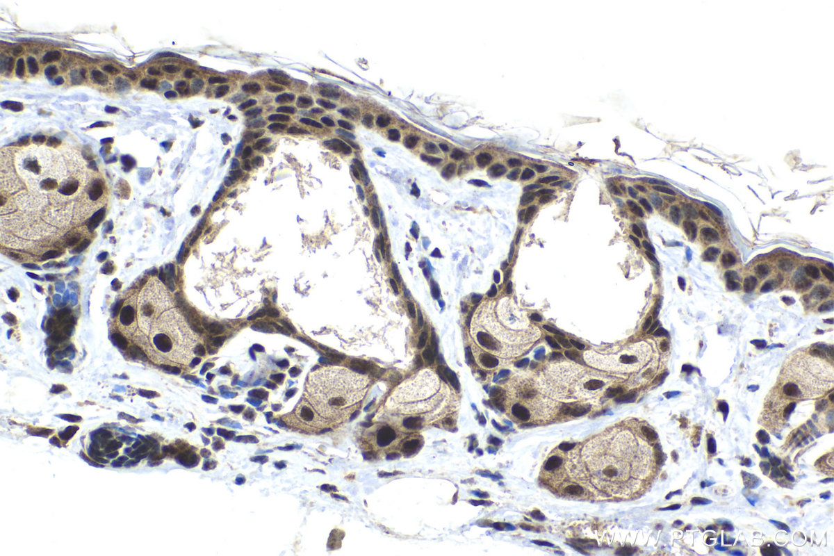 Immunohistochemical analysis of paraffin-embedded mouse skin tissue slide using KHC1993 (GTF3C4 IHC Kit).