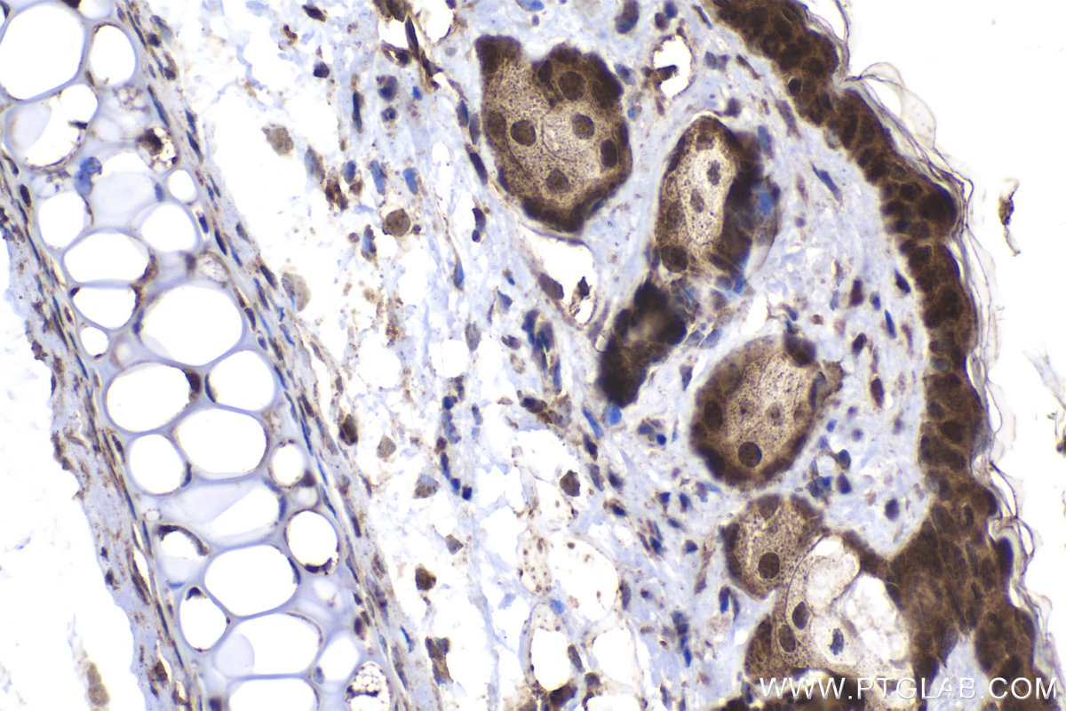 Immunohistochemical analysis of paraffin-embedded mouse skin tissue slide using KHC2031 (GTL3 IHC Kit).