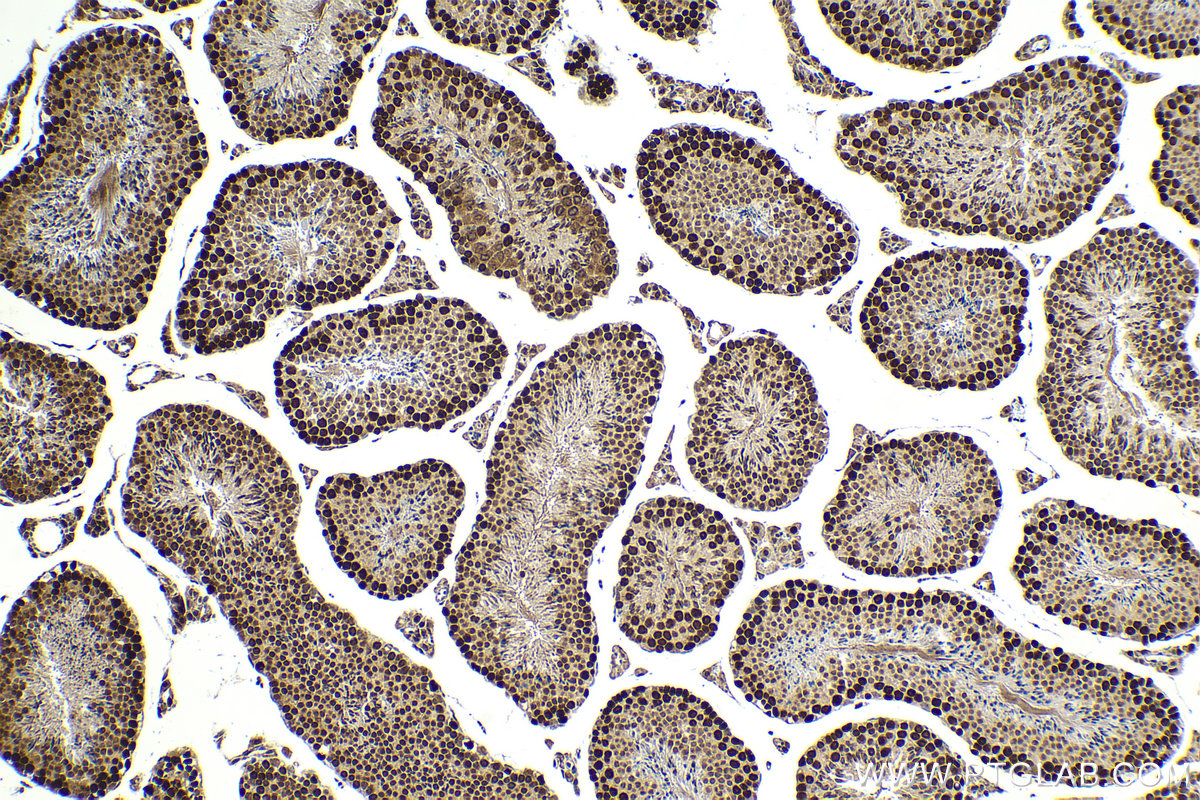 Immunohistochemical analysis of paraffin-embedded mouse testis tissue slide using KHC2062 (HAT1 IHC Kit).