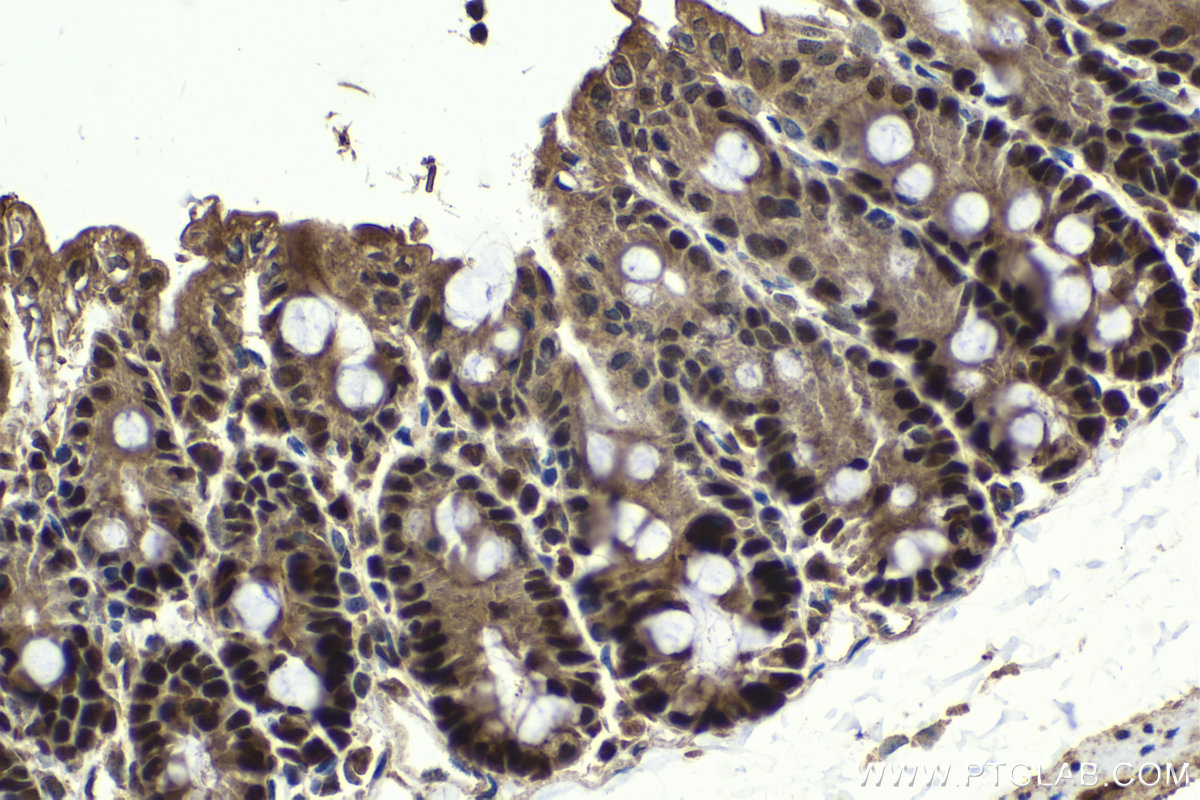 Immunohistochemical analysis of paraffin-embedded mouse small intestine tissue slide using KHC2062 (HAT1 IHC Kit).