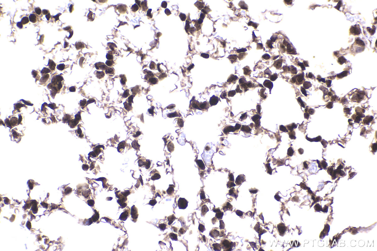 Immunohistochemical analysis of paraffin-embedded mouse lung tissue slide using KHC2330 (HDAC4 IHC Kit).