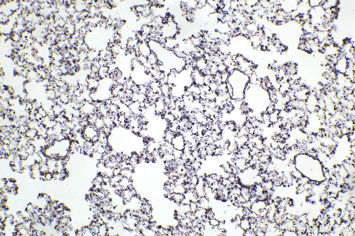 Immunohistochemical analysis of paraffin-embedded rat lung tissue slide using KHC2330 (HDAC4 IHC Kit).