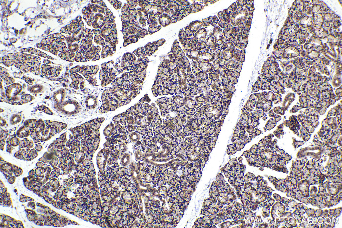 Immunohistochemical analysis of paraffin-embedded rat salivary gland tissue slide using KHC2330 (HDAC4 IHC Kit).