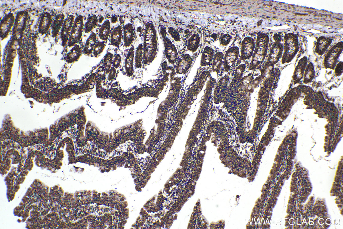 Immunohistochemical analysis of paraffin-embedded rat small intestine tissue slide using KHC2330 (HDAC4 IHC Kit).