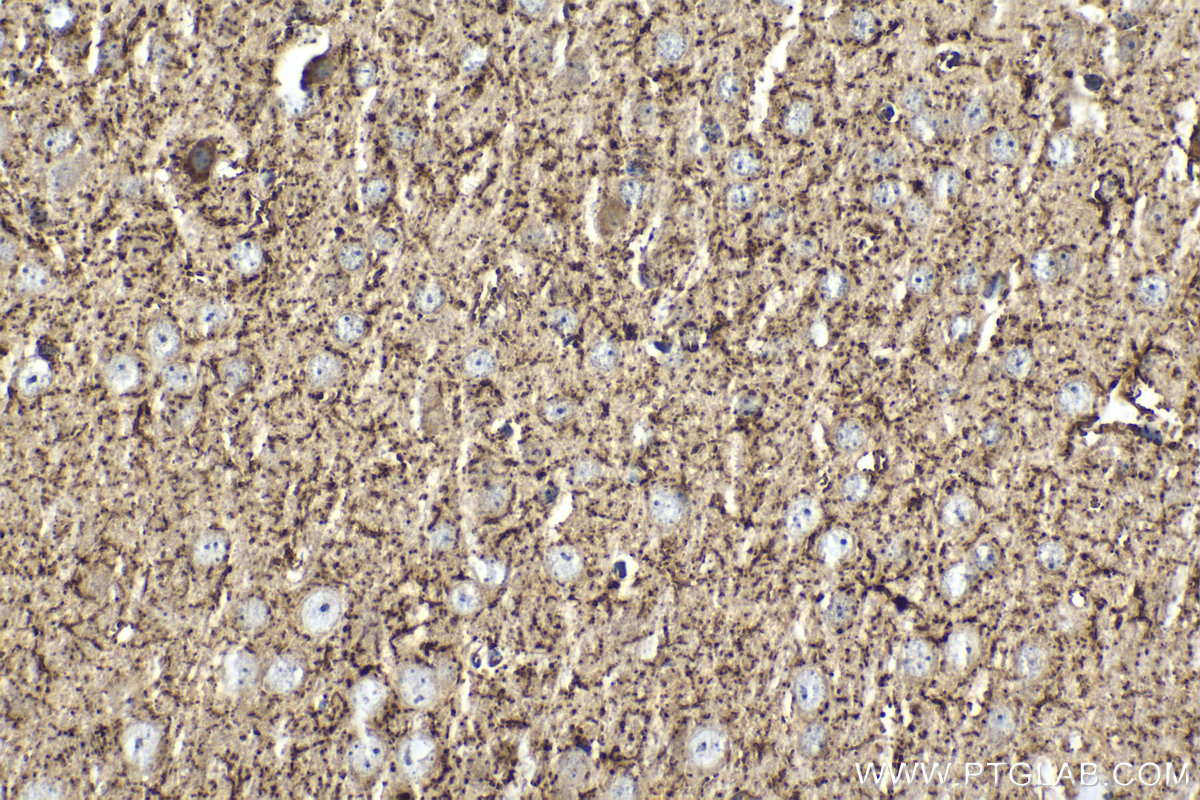 Immunohistochemical analysis of paraffin-embedded mouse brain tissue slide using KHC2036 (HDDC2 IHC Kit).