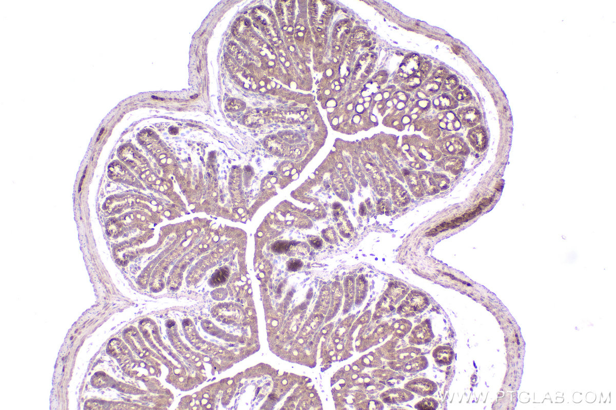 Immunohistochemical analysis of paraffin-embedded mouse colon tissue slide using KHC2553 (HECTD3 IHC Kit).