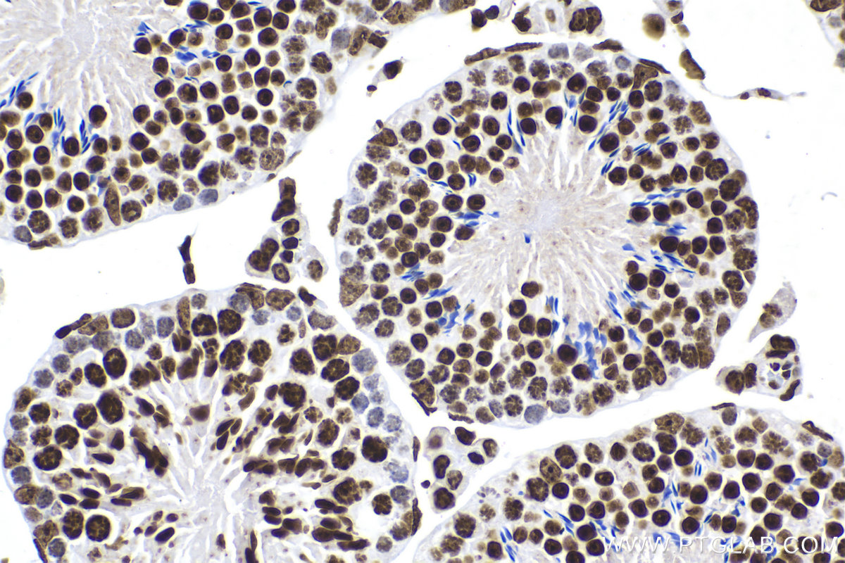 Immunohistochemical analysis of paraffin-embedded mouse testis tissue slide using KHC2193 (HIST1H1B IHC Kit).