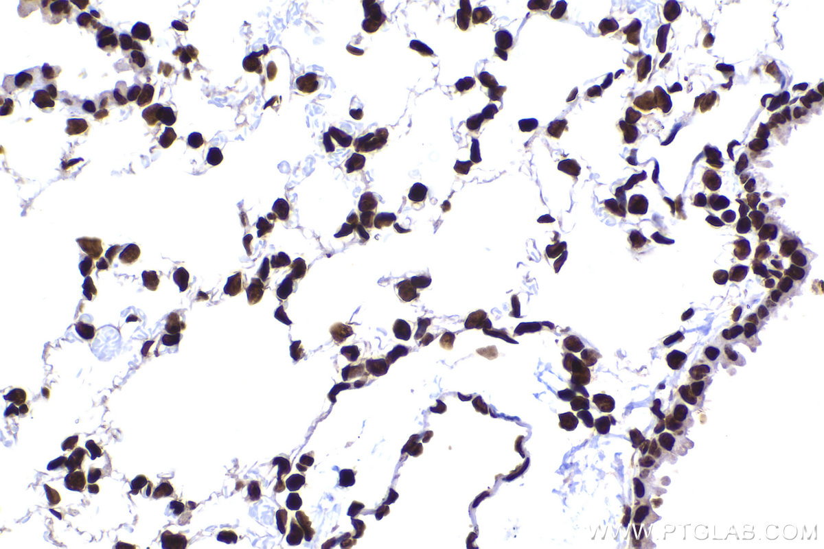 Immunohistochemical analysis of paraffin-embedded mouse lung tissue slide using KHC2193 (HIST1H1B IHC Kit).