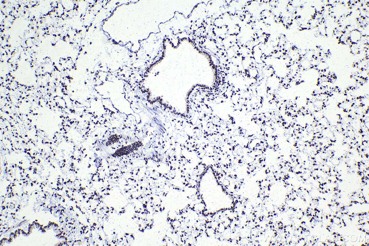 Immunohistochemical analysis of paraffin-embedded rat lung tissue slide using KHC2193 (HIST1H1B IHC Kit).