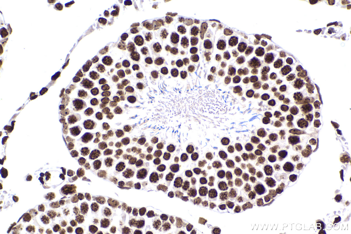 Immunohistochemical analysis of paraffin-embedded rat testis tissue slide using KHC2193 (HIST1H1B IHC Kit).