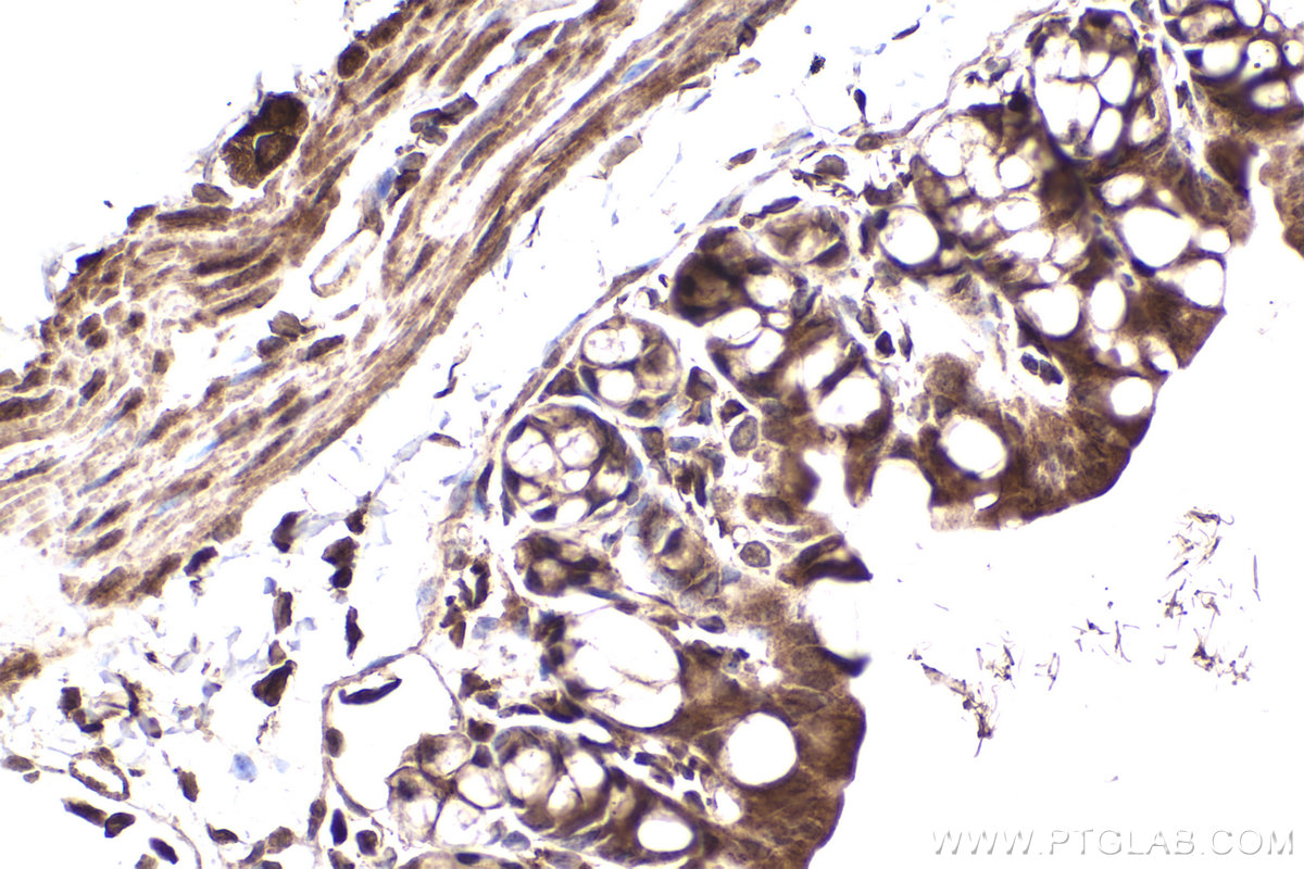 Immunohistochemical analysis of paraffin-embedded mouse small intestine tissue slide using KHC2229 (HMOX2 IHC Kit).