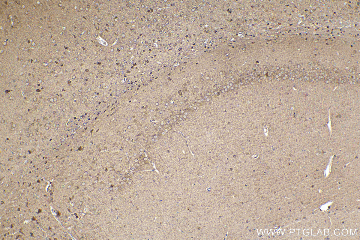 Immunohistochemical analysis of paraffin-embedded mouse brain tissue slide using KHC2229 (HMOX2 IHC Kit).