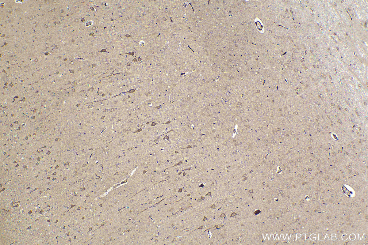 Immunohistochemical analysis of paraffin-embedded rat brain tissue slide using KHC2229 (HMOX2 IHC Kit).