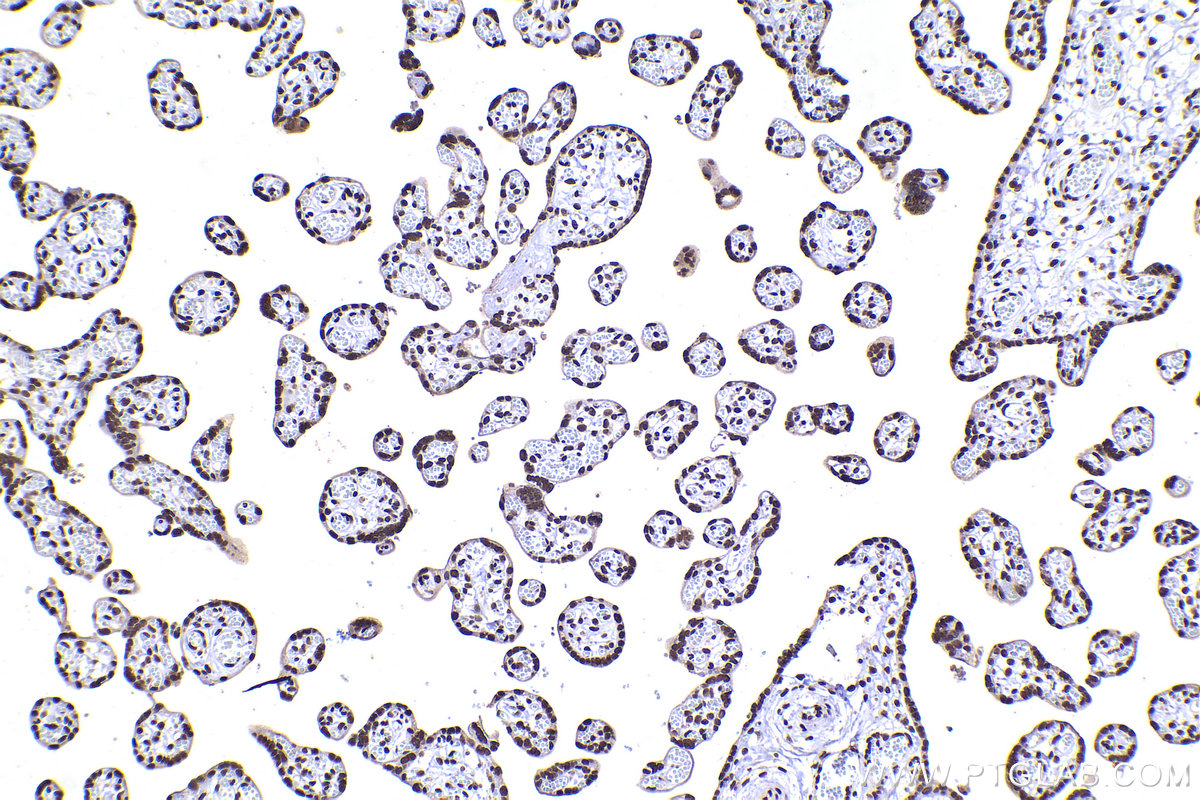 Immunohistochemical analysis of paraffin-embedded human placenta tissue slide using KHC2236 (HNRNPH1 IHC Kit).