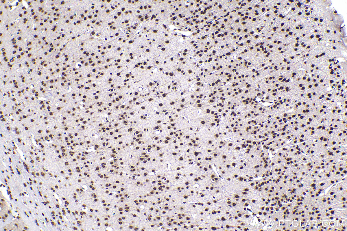 Immunohistochemical analysis of paraffin-embedded mouse brain tissue slide using KHC2236 (HNRNPH1 IHC Kit).