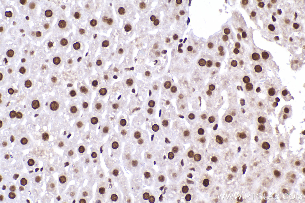 Immunohistochemical analysis of paraffin-embedded mouse liver tissue slide using KHC2309 (HNRNPM IHC Kit).