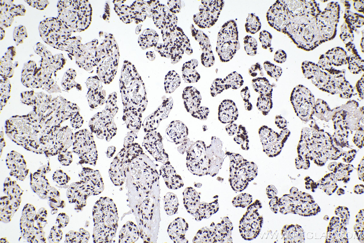 Immunohistochemical analysis of paraffin-embedded human placenta tissue slide using KHC2309 (HNRNPM IHC Kit).