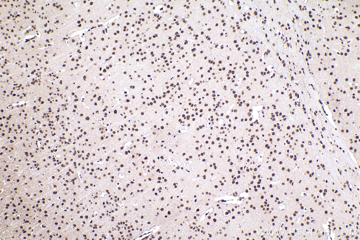 Immunohistochemical analysis of paraffin-embedded mouse brain tissue slide using KHC2309 (HNRNPM IHC Kit).