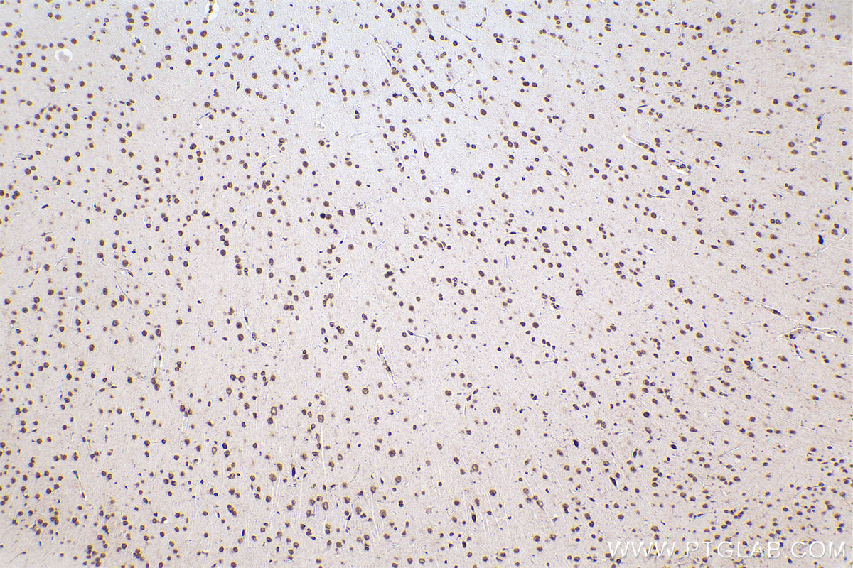 Immunohistochemical analysis of paraffin-embedded rat brain tissue slide using KHC2309 (HNRNPM IHC Kit).